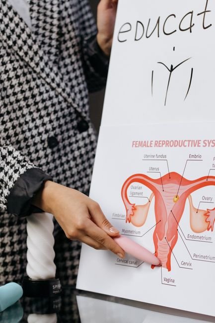 Planche pédagogique de l'appareil reproducteur féminin, utilisée pour expliquer le fonctionnement du stérilet